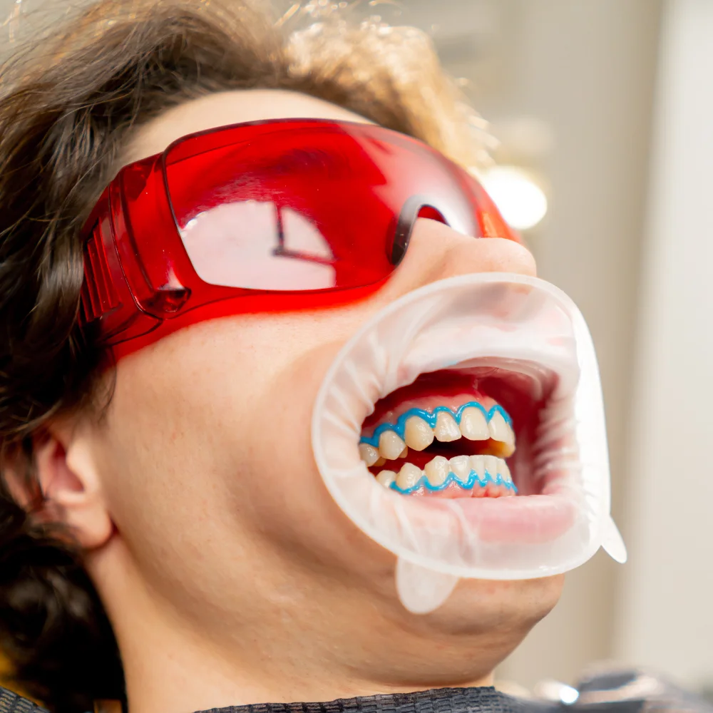 dental-office-guy-sits-during-a-whitening-procedur-RZH6MZL.webp